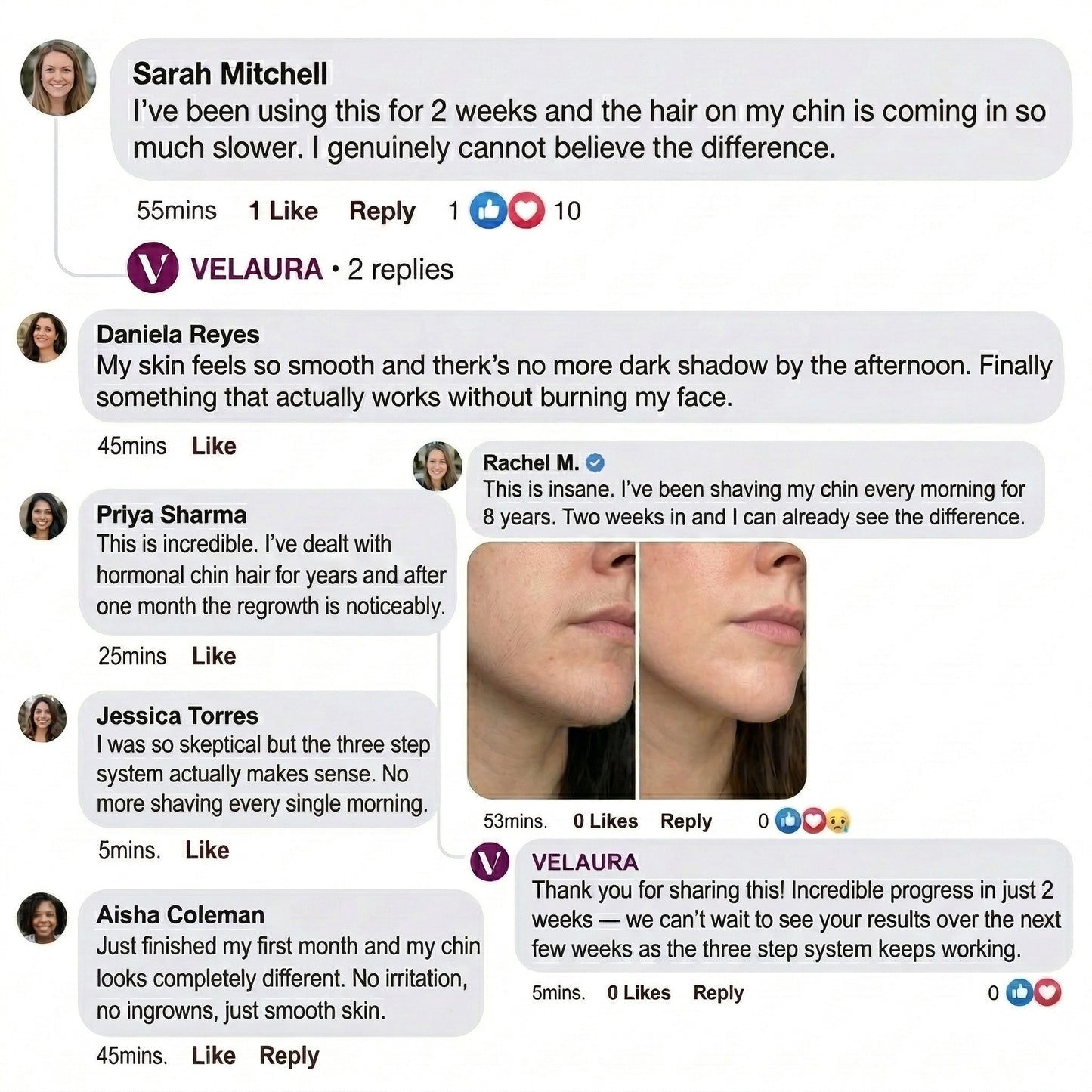 Velaura Hair Removal Trilogy Kit — For Hormonal & PCOS Facial Hair